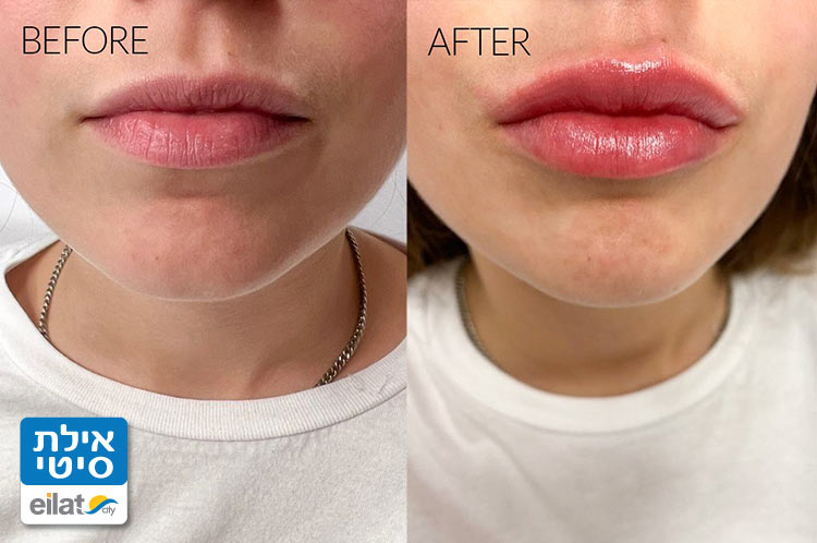 עיצוב שפתיים למראה מושלם