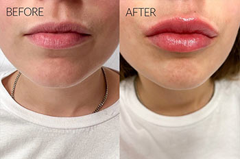 עיצוב שפתיים למראה מושלם